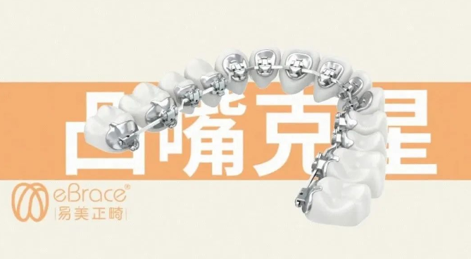 尊嘟假嘟？！听说能让嘴凸牙友们逆袭的竟然是...